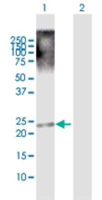 Western Blot: TRIML1 Antibody [H00339976-D01P] - Analysis of TRIML1 expression in transfected 293T cell line by TRIML1 polyclonal antibody.Lane 1: TRIML1 transfected lysate(21.40 KDa).Lane 2: Non-transfected lysate.