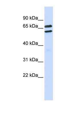 Western Blot: TRIML1 Antibody [NBP1-54340] - Human Placenta lysate, concentration 0.2-1 ug/ml.