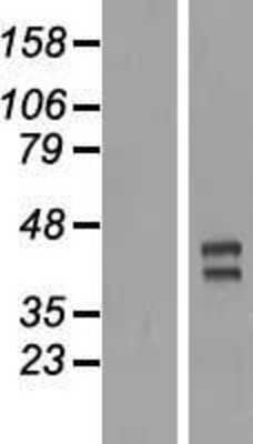 Western Blot: TRIML2 Overexpression Lysate (Adult Normal) [NBL1-17317] Left-Empty vector transfected control cell lysate (HEK293 cell lysate); Right -Over-expression Lysate for TRIML2.