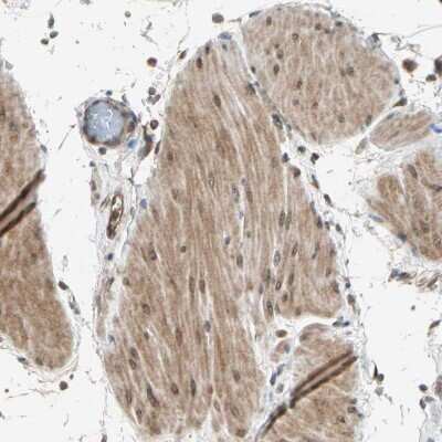 Immunohistochemistry-Paraffin: TRIO Antibody [NBP1-88822] - Staining of human colon shows moderate cytoplasmic positivity in smooth muscle cells.