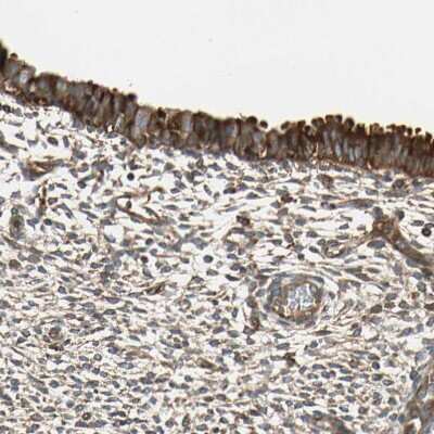 Immunohistochemistry-Paraffin: TRIO Antibody [NBP1-88822] - Staining of human endometrium shows strong cytoplasmic positivity in glandular cells.