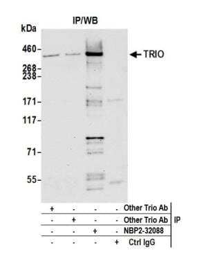 <b>Independent Antibodies Validation. </b>Immunoprecipitation: TRIO Antibody [NBP2-32088] - Detection of human TRIO by western blot of immunoprecipitates. Samples: Whole cell lysate (1.0 mg per IP reaction; 20% of IP loaded) from 293T cells prepared using NETN lysis buffer. Antibodies: Affinity purified rabbit anti-TRIO antibody NBP2-32088 used for IP at 3 ug per reaction. TRIO was also immunoprecipitated by 2 other rabbit anti-TRIO antibodies. For blotting immunoprecipitated TRIO, NBP2-32088 was used at 1 ug/ml. Detection: Chemiluminescence with an exposure time of 30 seconds.