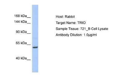 Western Blot: TRIO Antibody [NBP2-88481] - Host: Rabbit. Target Name: TRIO. Sample Type: 721_B Whole Cell lysates. Antibody Dilution: 1.0ug/mlTRIO is strongly supported by BioGPS gene expression data to be expressed in Human 721_B cells