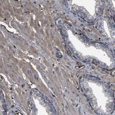 Immunohistochemistry-Paraffin: TRIOBP Antibody [NBP1-90589] - Staining of human prostate shows weak cytoplasmic positivity in smooth muscle cells.