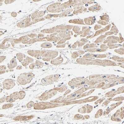 Immunohistochemistry-Paraffin: TRIOBP Antibody [NBP1-90590] - Staining of human heart muscle shows moderate cytoplasmic positivity in myocytes.