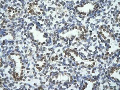 Immunohistochemistry-Paraffin: TRIOBP Antibody [NBP2-88482] - Paraffin Embedded Tissue: Human alveolar cell. Cellular Data: Epithelial cells of renal tubule. Antibody Concentration: 4.0-8.0 ug/ml. Magnification: 400X