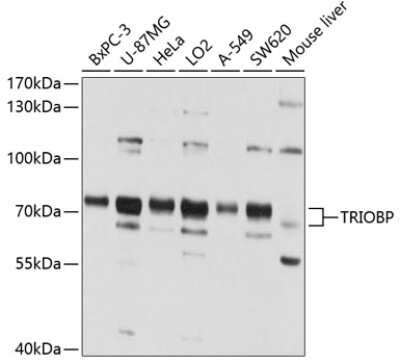 Western Blot: TRIOBP Antibody [NBP2-93144] - Analysis of extracts of various cell lines, using TRIOBP at 1:1000 dilution. Secondary antibody: HRP Goat Anti-Rabbit IgG (H+L) at 1:10000 dilution. Lysates/proteins: 25ug per lane. Blocking buffer: 3% nonfat dry milk in TBST. Detection: ECL Basic Kit . Exposure time: 15s.