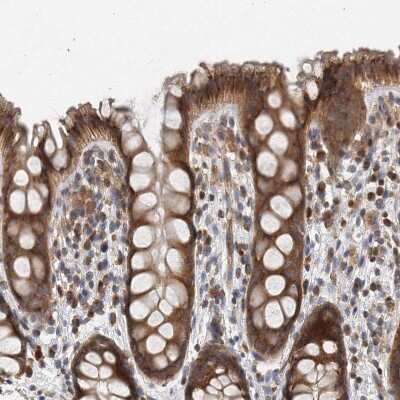 Immunohistochemistry-Paraffin: TRIP1 Antibody [NBP1-84873] - Staining of human rectum shows strong cytoplasmic positivity in glandular cells.