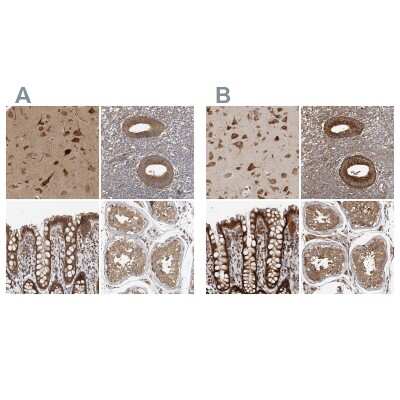 Immunohistochemistry-Paraffin: TRIP1 Antibody [NBP1-84873] - Staining of human cerebral cortex, endometrium, rectum and testis using Anti-EIF3I antibody (A) NBP1-84873 shows similar protein distribution across tissues to independent antibody NBP1-84874 (B).