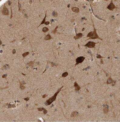 Immunohistochemistry-Paraffin: TRIP1 Antibody [NBP1-84873] -  Staining of human cerebral cortex strong cytoplasmic positivity in neurons.