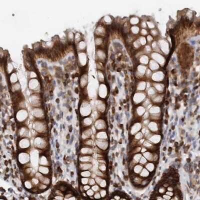 Immunohistochemistry-Paraffin: TRIP1 Antibody [NBP1-84874] - Staining of human rectum shows strong cytoplasmic positivity in glandular cells.