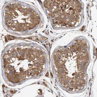 Immunohistochemistry-Paraffin: TRIP1 Antibody [NBP1-84874] - Staining of human testis shows strong cytoplasmic positivity in cells in seminiferous ducts.