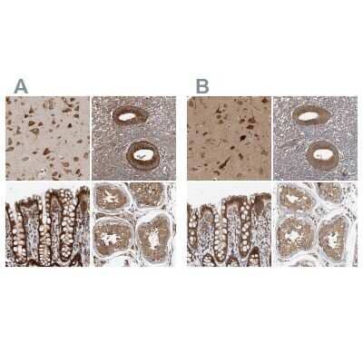 <b>Independent Antibodies Validation. </b>Immunohistochemistry-Paraffin: TRIP1 Antibody [NBP1-84874] - Staining of human cerebral cortex, endometrium, liver and urinary bladder using Anti-UPK2 antibody (A) NBP1-84874 shows similar protein distribution across tissues to independent antibody NBP1-84873 (B).