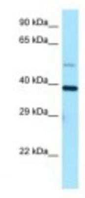 Western Blot: TRIP1 Antibody [NBP1-98293] - HepG2 Cell Lysate 1.0ug/ml, Gel Concentration: 12%