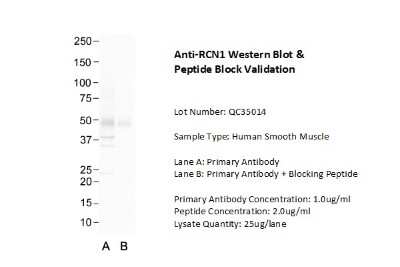 Western Blot: TRIP1 Antibody [NBP1-98293] - Sample Type: Human 293T Lane A: Primary Antibody Lane B: Primary Antibody + Blocking Peptide Primary Antibody Concentration: 1.0 ug/ml Peptide Concentration: 2.0 ug/ml Lysate Quantity: 25 ug/lane