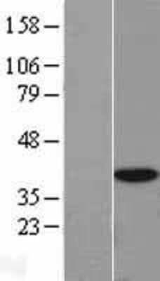 Western Blot: TRIP1 Overexpression Lysate (Adult Normal) [NBL1-10197] Left-Empty vector transfected control cell lysate (HEK293 cell lysate); Right -Over-expression Lysate for TRIP1.
