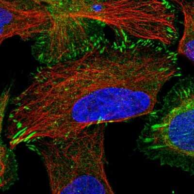 Immunocytochemistry/Immunofluorescence: TRIP6 Antibody [NBP2-33667] - Immunofluorescent staining of human cell line U-2 OS shows localization to plasma membrane, cytosol & focal adhesion sites.