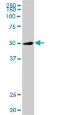 Western Blot: TRIP6 Antibody [H00007205-B01P] - Analysis of TRIP6 expression in MES-SA/Dx5.