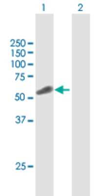 Western Blot: TRIP6 Antibody [H00007205-B01P] - Analysis of TRIP6 expression in transfected 293T cell line by TRIP6 polyclonal antibody.  Lane 1: TRIP6 transfected lysate(52.36 KDa). Lane 2: Non-transfected lysate.