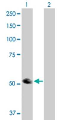 Western Blot: TRIP6 Antibody [H00007205-D01P] - Analysis of TRIP6 expression in transfected 293T cell line by TRIP6 polyclonal antibody.Lane 1: TRIP6 transfected lysate(50.30 KDa).Lane 2: Non-transfected lysate.