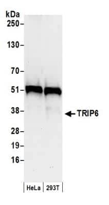 Western Blot: TRIP6 Antibody [NB100-79791] - Detection of Human TRIP6 by Western Blot. Samples: Whole cell lysate (50 ug) from HeLa and 293T cells prepared using NETN lysis buffer. Antibody: Affinity purified rabbit anti-TRIP6 antibody NB100-79791 used for WB at 0.1 ug/ml. Detection: Chemiluminescence with an exposure time of 10 seconds.