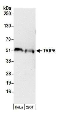 Western Blot: TRIP6 Antibody [NB100-79792] - Detection of Human TRIP6 by Western Blot. Samples: Whole cell lysate (50 ug) from HeLa and 293T cells prepared using NETN lysis buffer. Antibody: Affinity purified rabbit anti-TRIP6 antibody NB100-79792 used for WB at 0.1 ug/ml. Detection: Chemiluminescence with an exposure time of 30 seconds.