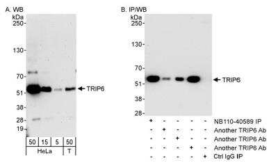 Western Blot: TRIP6 Antibody [NB110-40589] - Detection of Human TRIP6 on HeLa whole cell lysate using NB110-40589. TRIP6 was also immunoprecipitated by other rabbit anti-TRIP6 antibodies.