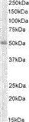 Western Blot: TRIP6 Antibody [NBP1-52026] - (2ug/ml) staining of K562 lysate (35ug protein in RIPA buffer). Primary incubation was 1 hour. Detected by chemiluminescence.