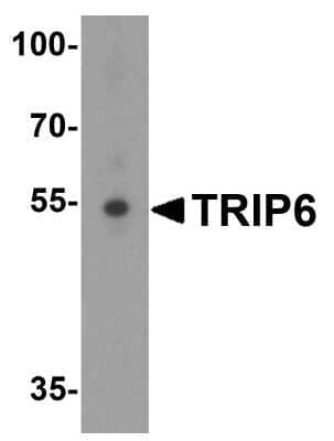 Western Blot: TRIP6 Antibody [NBP1-76305] - Analysis in A431 cell lysate with antibody at 1 ug/mL.