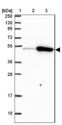 Western Blot: TRIP6 Antibody [NBP2-33667] - Lane 1: Marker  [kDa] 250, 130, 95, 72, 55, 36, 28, 17, 10.  Lane 2: Human cell line RT-4.  Lane 3: Human cell line U-251MG sp