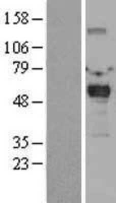 Western Blot: TRIP6 Overexpression Lysate (Adult Normal) [NBL1-17321] Left-Empty vector transfected control cell lysate (HEK293 cell lysate); Right -Over-expression Lysate for TRIP6.