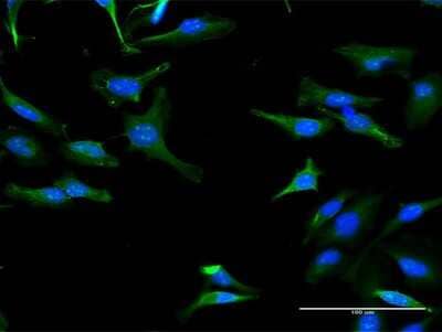 Immunocytochemistry/Immunofluorescence: TRIT1 Antibody [H00054802-B01P] - Analysis of purified antibody to TRIT1 on HeLa cell. (antibody concentration 30 ug/ml)