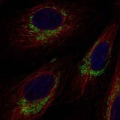 Immunocytochemistry/Immunofluorescence: TRIT1 Antibody [NBP3-17951] - Staining of human cell line U-2 OS shows localization to mitochondria.