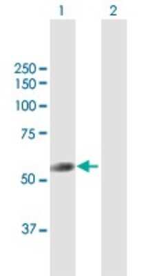 Western Blot: TRIT1 Antibody [H00054802-B01P] - Analysis of TRIT1 expression in transfected 293T cell line by TRIT1 polyclonal antibody.  Lane 1: TRIT1 transfected lysate(51.37 KDa). Lane 2: Non-transfected lysate.