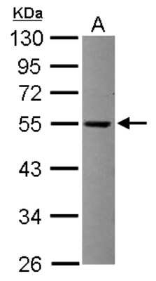 Western Blot: TRIT1 Antibody [NBP2-20727] - Sample (30 ug of whole cell lysate) A: Raji 10% SDS PAGE gel, diluted at 1:1000.