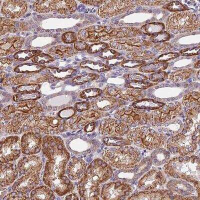 Immunohistochemistry-Paraffin TRM1 Antibody - BSA Free