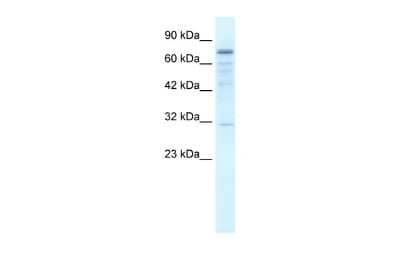 Western Blot: TRM1 Antibody [NBP2-86002] - WB Suggested Anti-FLJ20244 Antibody Titration: 2.5ug/ml. ELISA Titer: 1:12500. Positive Control: Jurkat cell lysateTRMT1 is strongly supported by BioGPS gene expression data to be expressed in Human Jurkat cells