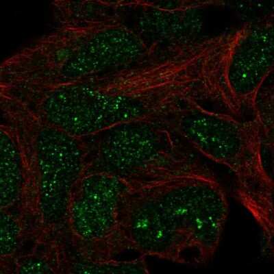 Immunocytochemistry/ Immunofluorescence TRM11 Antibody - BSA Free