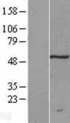 Western Blot: TRM11 Overexpression Lysate (Adult Normal) [NBL1-17322] Left-Empty vector transfected control cell lysate (HEK293 cell lysate); Right -Over-expression Lysate for TRM11.