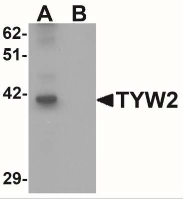 Western Blot TRMT12 Antibody - BSA Free