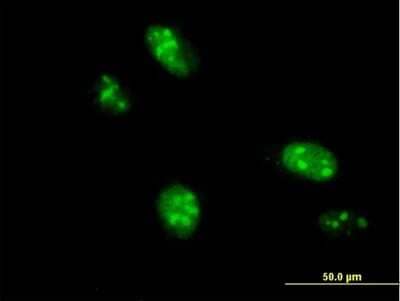 Immunocytochemistry/Immunofluorescence: TRMT1L Antibody [H00081627-B01P] - Analysis of purified antibody to C1orf25 on HeLa cell. (antibody concentration 10 ug/ml)
