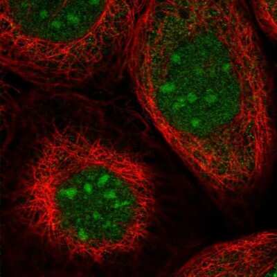 Immunocytochemistry/Immunofluorescence: TRMT1L Antibody [NBP1-88337] - Immunofluorescent staining of human cell line A-431 shows localization to nucleus & nucleoli.