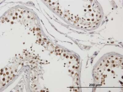 Immunohistochemistry-Paraffin: TRMT1L Antibody [H00081627-B01P] - Analysis of purified antibody to C1orf25 on formalin-fixed paraffin-embedded human testis. (antibody concentration 3 ug/ml)