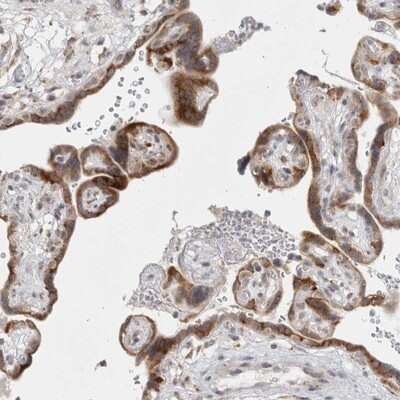 Immunohistochemistry-Paraffin: TRMT1L Antibody [NBP1-88337] - Staining of human placenta shows strong cytoplasmic positivity in trophoblastic cells.