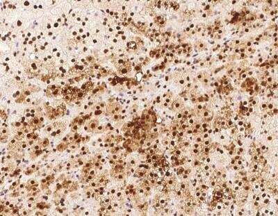 Immunohistochemistry-Paraffin: TRMT1L Antibody [NBP3-12621] - Staining of human C1orf25 in human adrenal gland with rabbit polyclonal antibody at 1:500 dilution.
