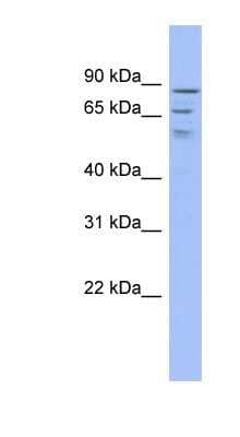 Western Blot: TRMT1L Antibody [NBP1-80371] - Titration: 0.2-1 ug/ml, Positive Control: ACHN cell lysate.