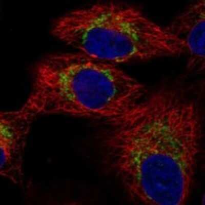 Immunocytochemistry/Immunofluorescence: TRMT61A Antibody [NBP3-17448] - Staining of human cell line A549 shows localization to mitochondria.