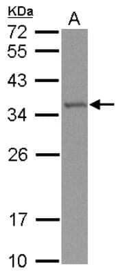 Western Blot: TRMT61A Antibody [NBP2-20728] - Sample (30 ug of whole cell lysate) A: NT2D1 12% SDS PAGE gel, diluted at 1:1000.