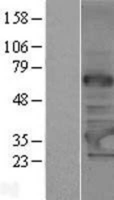 Western Blot: TRMT61A Overexpression Lysate (Adult Normal) [NBP2-05408] Left-Empty vector transfected control cell lysate (HEK293 cell lysate); Right -Over-expression Lysate for TRMT61A.