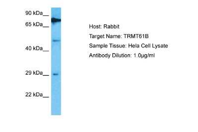 Western Blot: TRMT61B Antibody [NBP2-88485] - Host: Rabbit. Target Name: TRMT61B. Sample Type: Hela Whole Cell lysates. Antibody Dilution: 1.0ug/ml